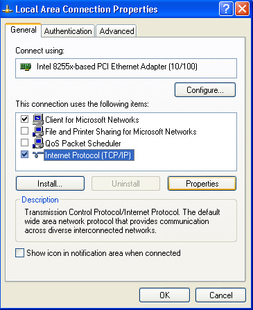 Local Area Connection Properties - General Tab - Options display.